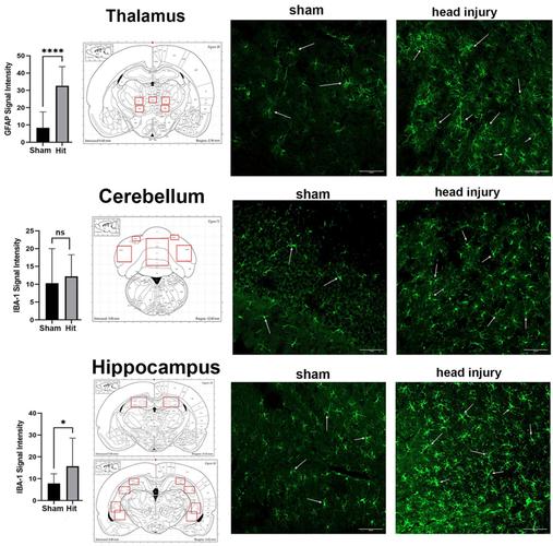 ET T11 鼠标核心规格参数展示