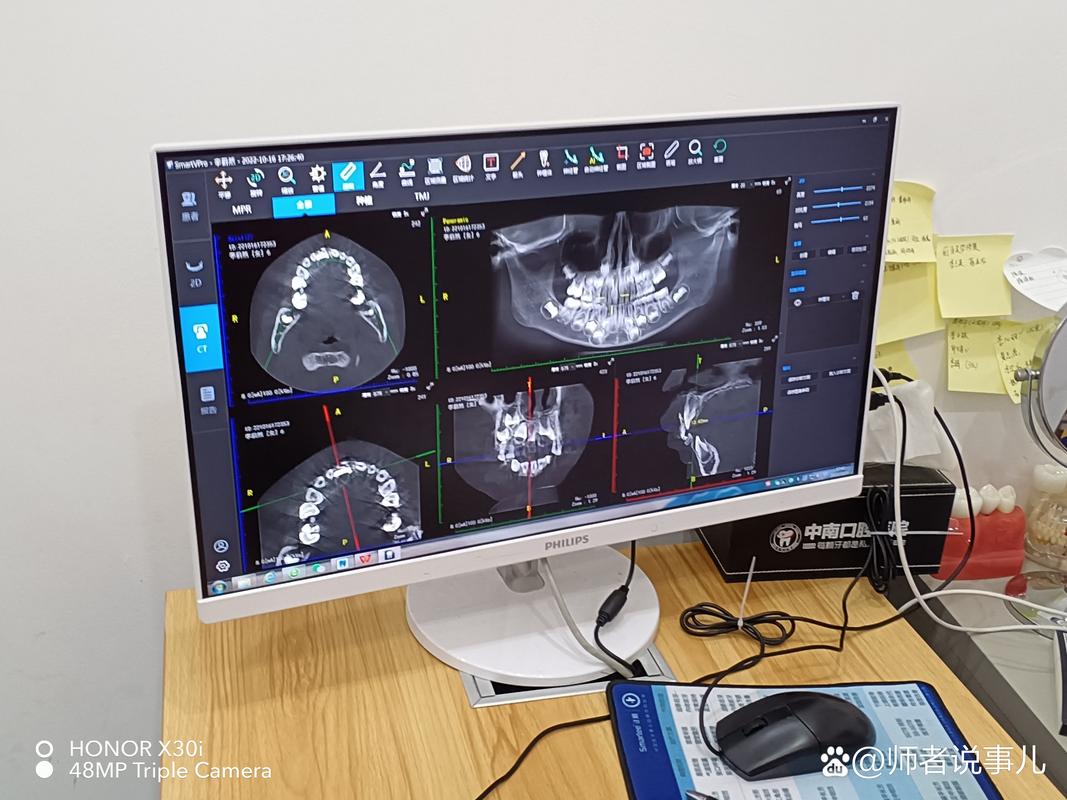 黑色显示器侧面展示设计