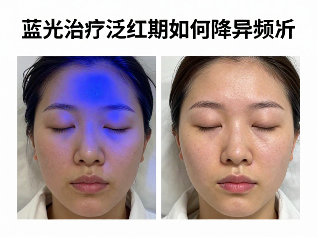 降低频次的安全策略与替代方案