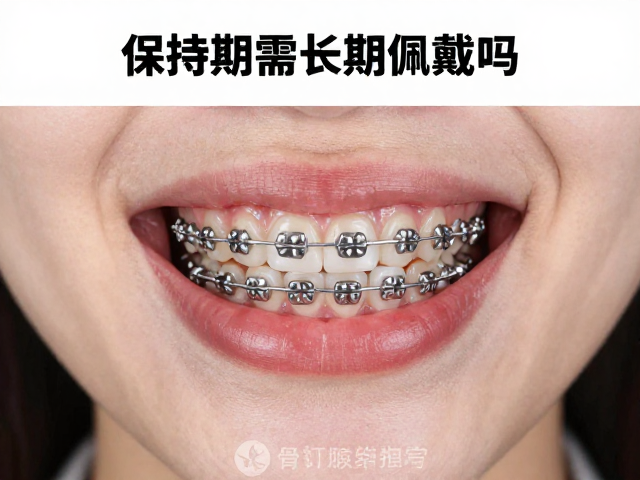 保持期的必要性与佩戴时长解析