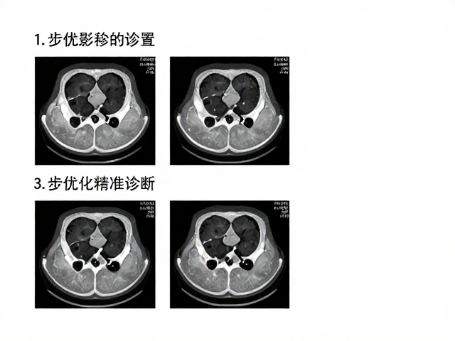 扫描参数设置对伪影抑制的影响