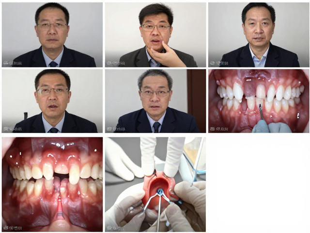 远程会诊在疑难病例中的协同机制