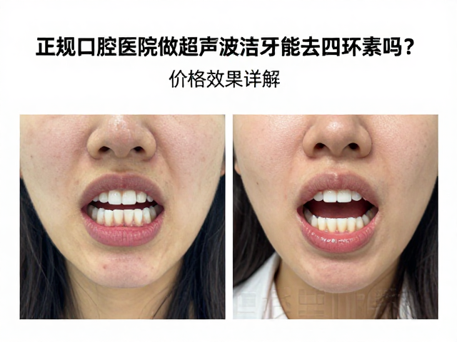 正规口腔医院的替代诊疗方案与真实效果