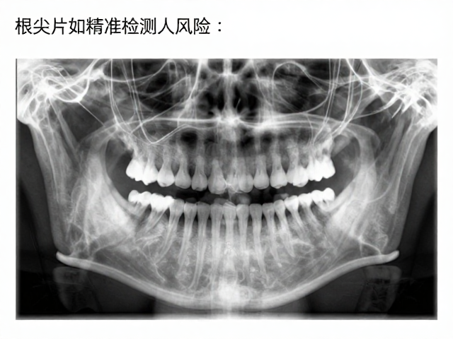影像特征与龋损进展的关联评估