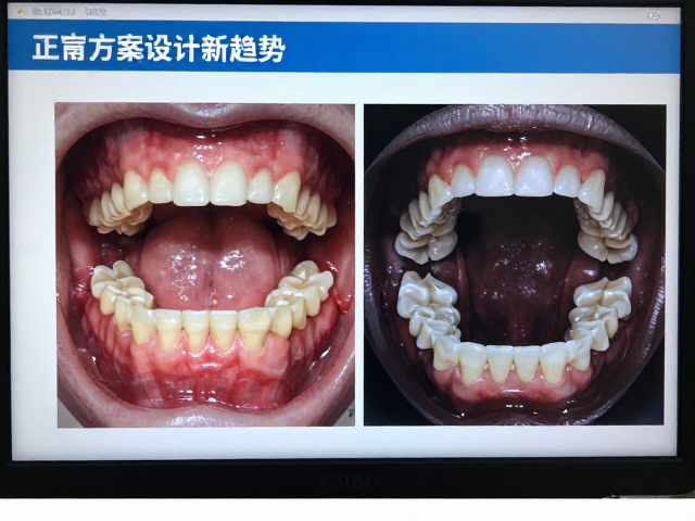 医疗影像中心的数据整合与可视化优势