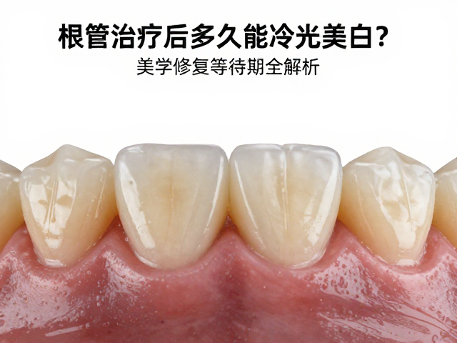 修复体材料对美白效果的阻隔效应