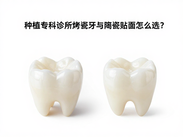 种植专科诊所烤瓷牙与陶瓷贴面修复对比,全瓷牙修复怎么选?