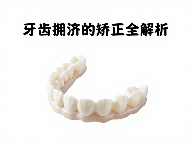 隐形矫治联合口扫技术的临床优势