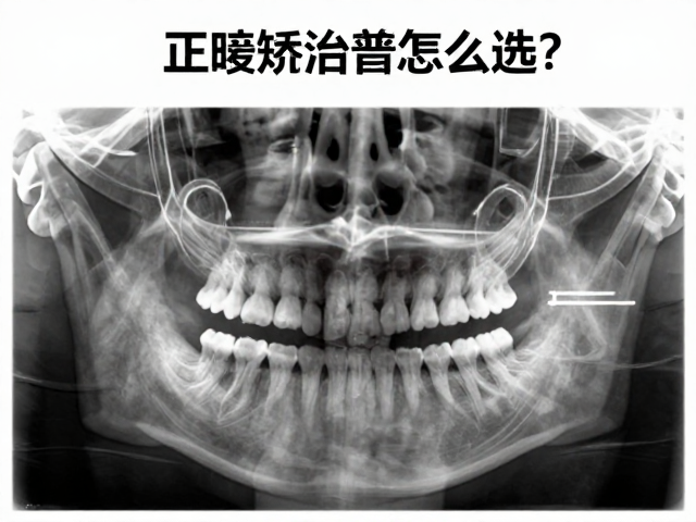 基于影像评估的矫治器选择逻辑