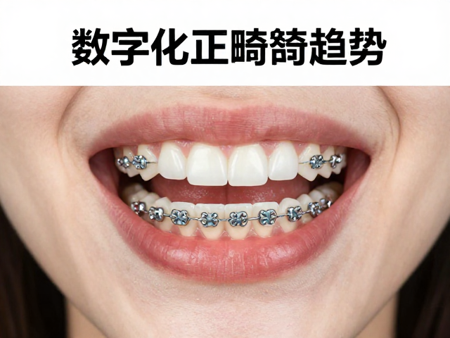 传统托槽的技术优势与精准控制