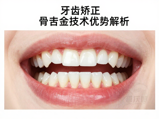 骨结合辅助正畸的适应症范围与疗效表现