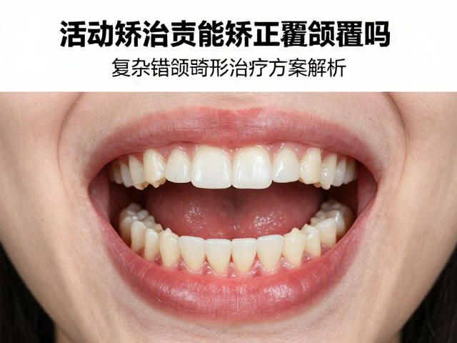 固定矫治器与隐形矫治的协同作用