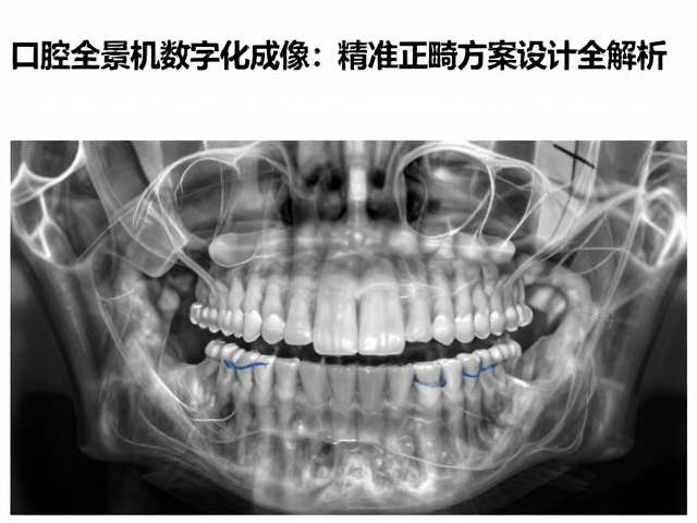 正畸方案设计中的影像数据应用