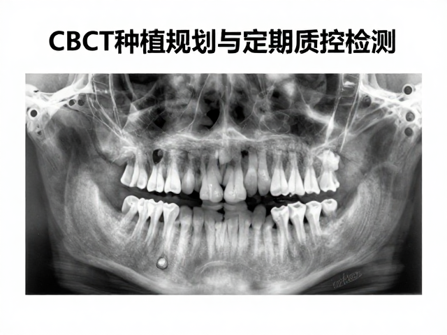 CBCT种植规划的核心价值与临床应用