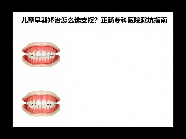 不同支抗形式的适应症与风险评估