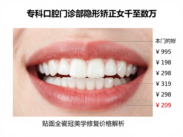 全瓷贴面的美学修复逻辑与成本构成