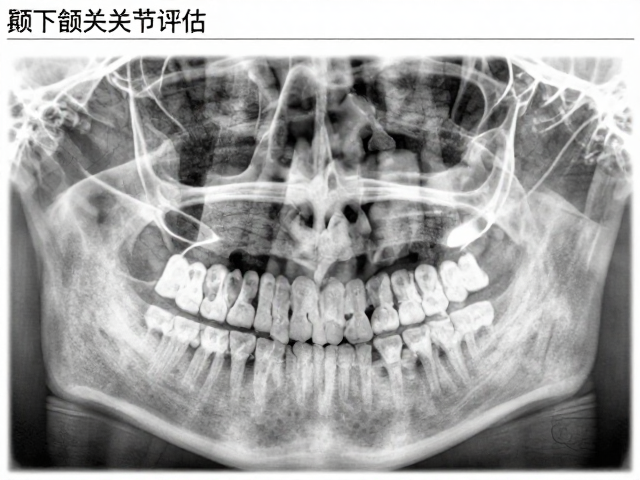 牙周健康报告,颞下颌关节评估,定期复查重要性解析