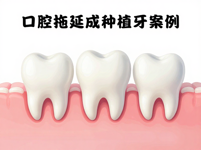 经济与时间成本的双重考量:预防优于补救