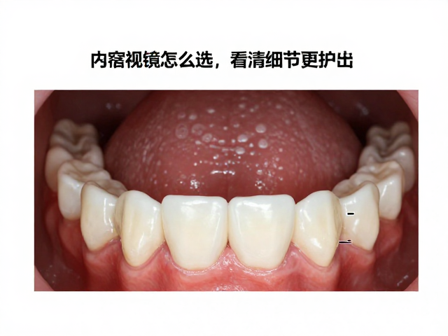 细节成像:从微观结构辅助精准诊断