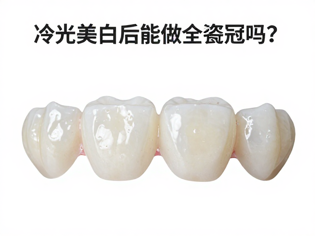 冷光美白后能做全瓷冠吗？严格无菌操作规范解析