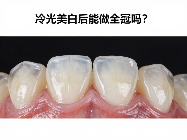 粘接界面的微渗漏控制与密封性