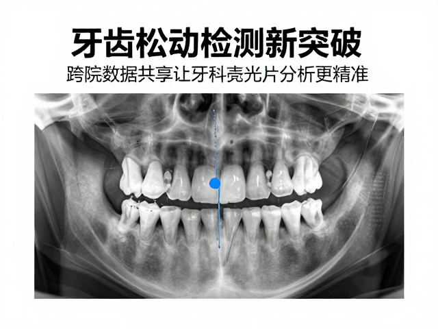 牙齿松动检测新突破,跨院数据共享让牙科X光片分析更精准