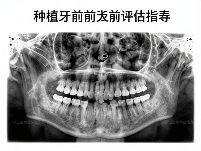 全景X光片在骨量与解剖结构评估中的关键作用