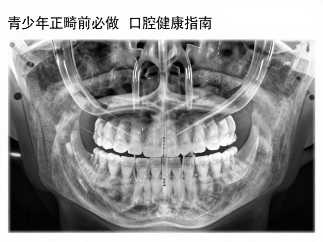 青少年正畸前必做,口腔健康问卷,全景片评估指南