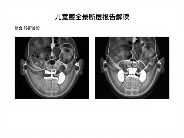 儿童口腔全景断层扫描报告解读，综合诊断结论与发育评估