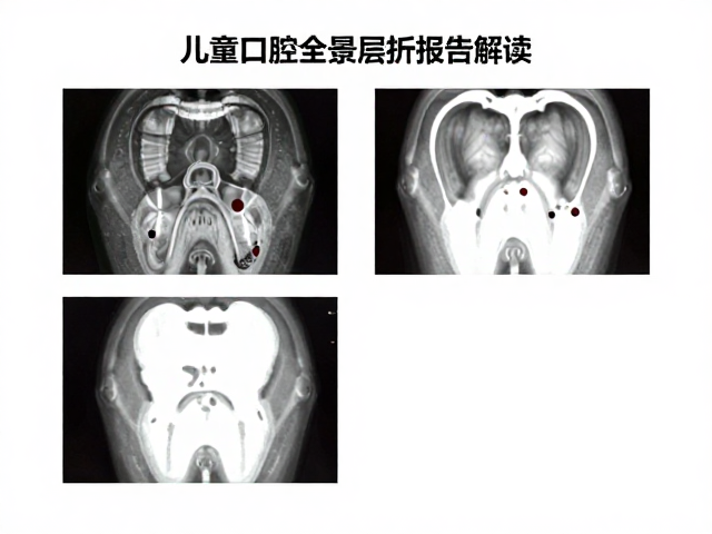 生长发育监测与长期随访
