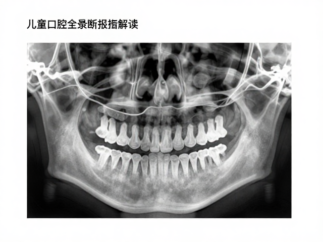 颌骨发育与错颌畸形评估