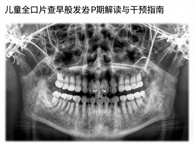 科学干预指南与家庭护理策略