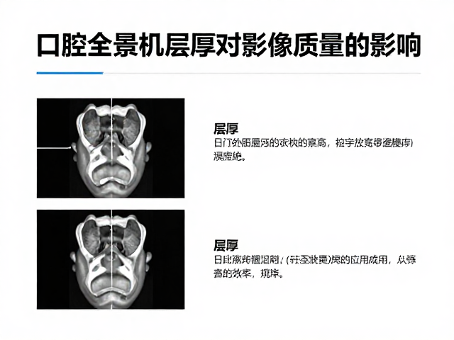 口腔全景机层厚对影像质量的影响，定期质控检测指南