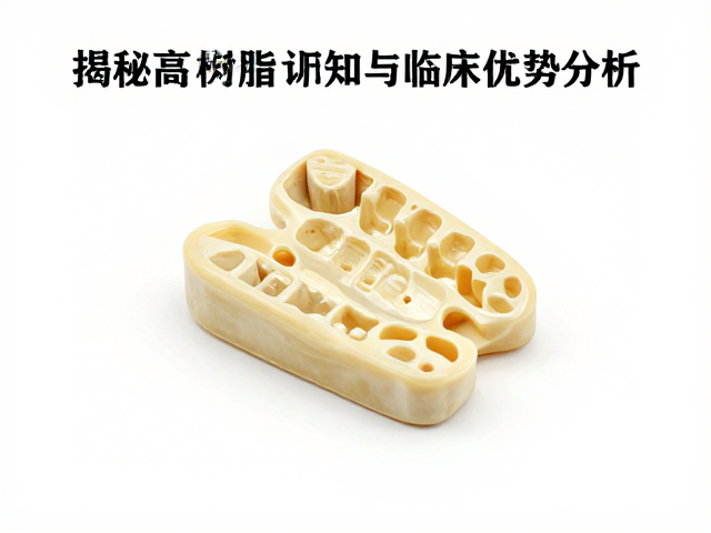 高分子树脂印模材的临床优势与应用场景