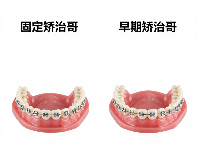 个性化定制与隐形固定式托槽的技术特点