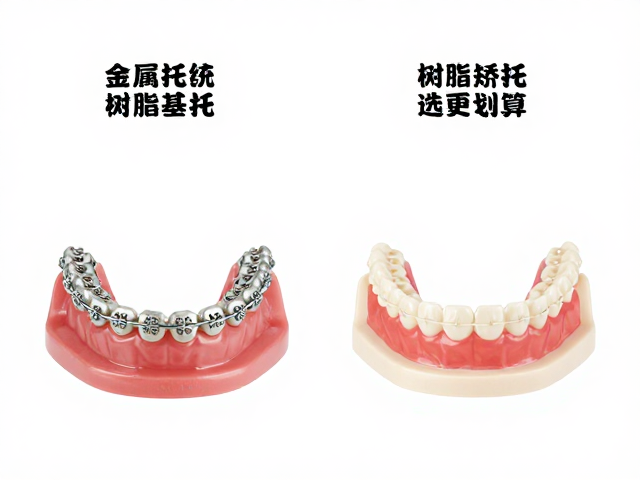 传统金属托槽与树脂基托区别？固定矫治器怎么选更划算