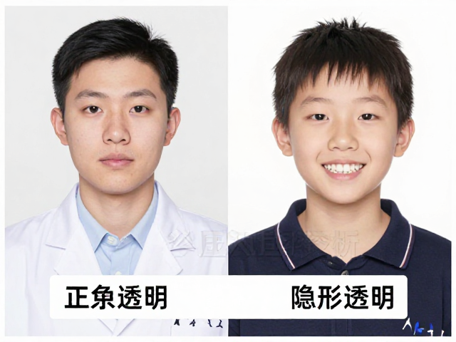 青少年混合牙列矫正选固定还是隐形透明？专家对比解析