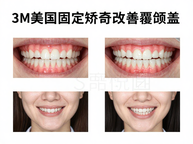 临床选择指南与长期维护要点