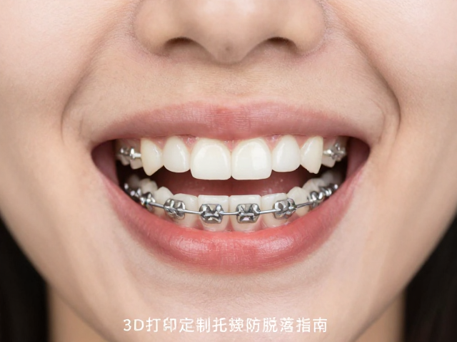 患者日常维护与稳固性影响因素