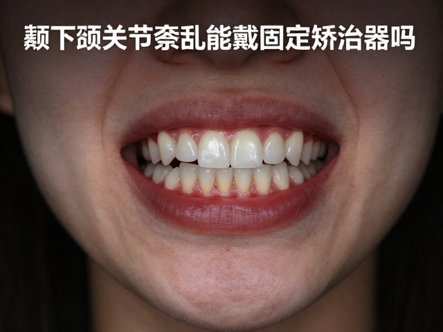 颞下颌关节紊乱能戴固定矫治器吗?牙齿排列整齐需警惕关节负担