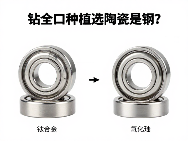 钻全口种植选陶瓷还是钢？轴承类型决定种植寿命与费用
