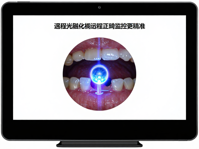 远程监控下的数据精准度提升