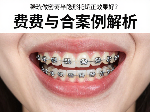 费用构成与市场行情参考