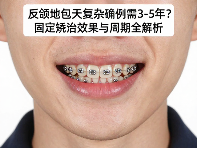 固定矫治在复杂反颌中的力学机制与临床挑战