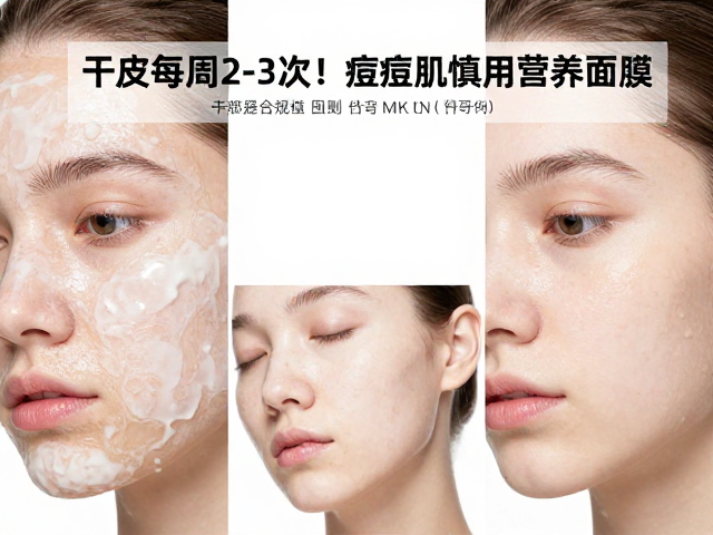 干皮每周2-3次!先做局部测试,痘痘肌慎用高营养面膜