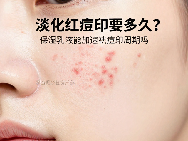 科学应对红色痘印的有效路径