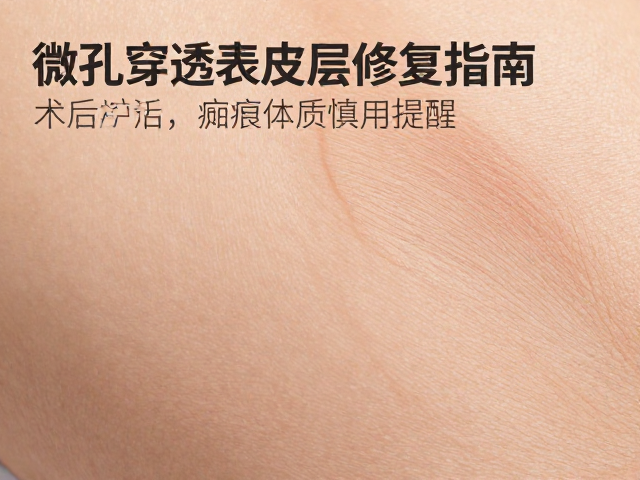 常见误区与长期维护建议