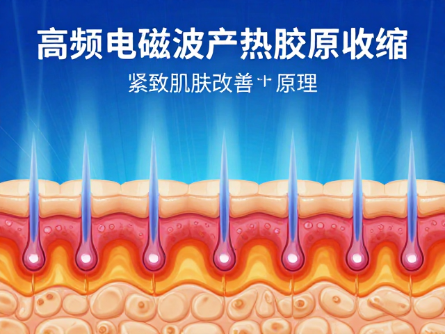 高频电磁波产热促胶原收缩，紧致肌肤改善松弛原理