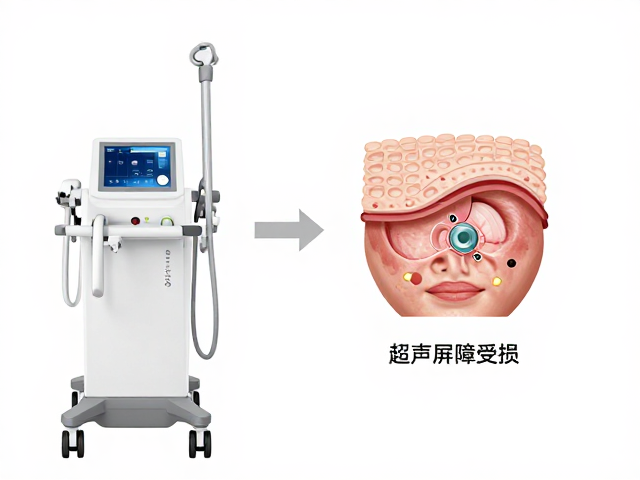 皮肤屏障受损的生理机制