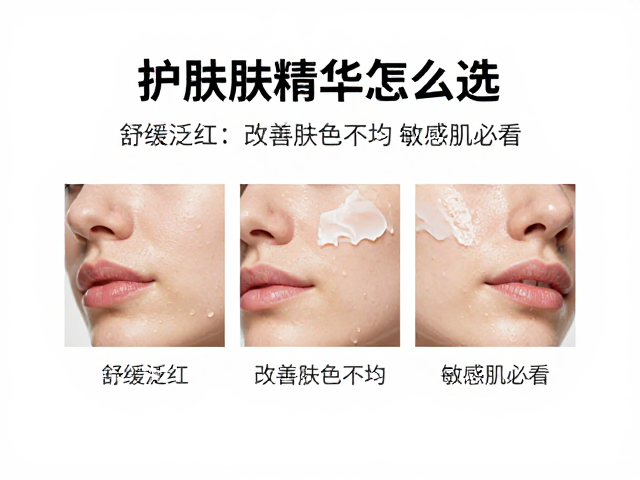 涂抹护肤精华怎么选？舒缓泛红，改善肤色不均，敏感肌必看